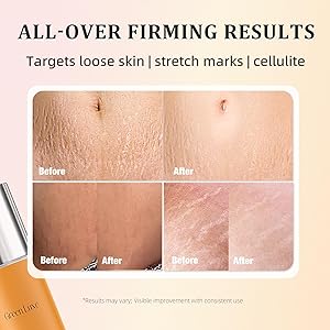 Green Luxe B Flat Belly Firming Cream  Skin Tightening Cream for Body: Lift & Tone Tummy, Thighs, Booty & Arms  Stretch Mark & Cellulite Sculpting Lotion for Women  3.38 Fl Oz