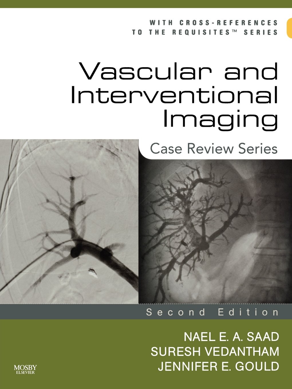 Buy Vascular and Interventional Imaging: Case Review Series (Old Edition) — BookShops.in