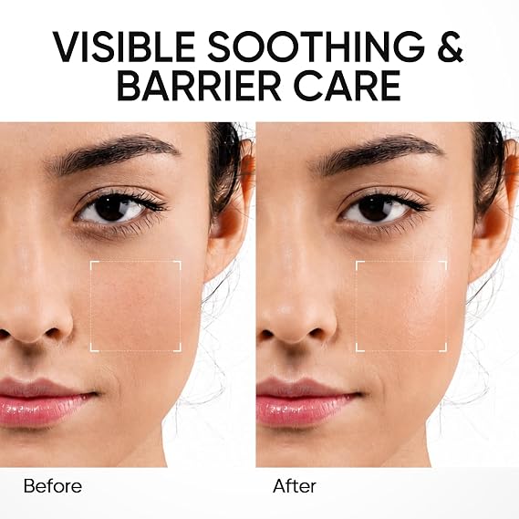 SKINTIFIC 5X Ceramide Barrier Repair Serum for Dry & Sensitive Skin Barrier Repair with Ceramide, Centella and Hyaluronic Acidx, Soothes Sensitive Skin, Reduces Redness & Strengthens Skin Barrier