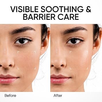 SKINTIFIC 5X Ceramide Barrier Repair Serum for Dry & Sensitive Skin Barrier Repair with Ceramide, Centella and Hyaluronic Acidx, Soothes Sensitive Skin, Reduces Redness & Strengthens Skin Barrier
