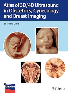 Atlas of 3D/4D Ultrasound in Obstetrics, Gynecology, and Breast Imaging: Principles and Practice