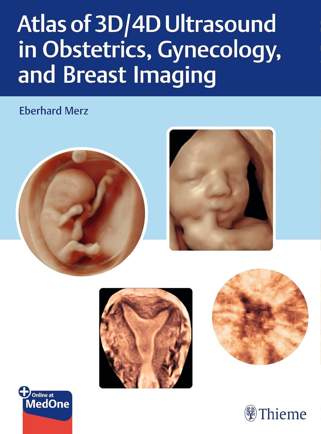 Atlas of 3D/4D Ultrasound in Obstetrics, Gynecology, and Breast Imaging