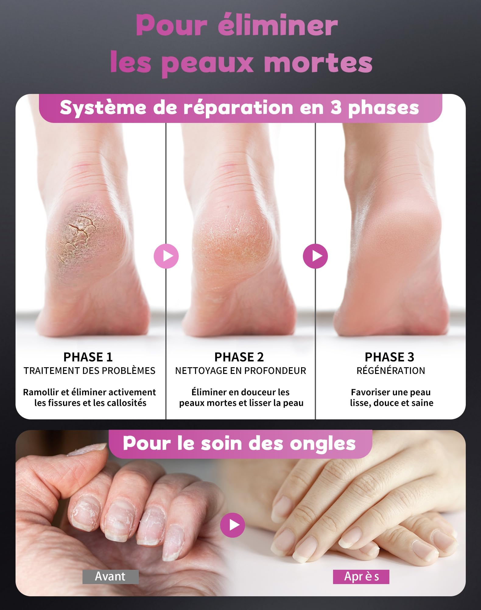 5 en 1 Rapeuse Pieds Électrique Ponceuse Pieds Electrique Râpe Pied Pédicure Rappe Pieds Lime HoneyGlow 9 vitesses réglables 4500tr/min Rechargeable 2000Mah Anti-Callosités(Gris)