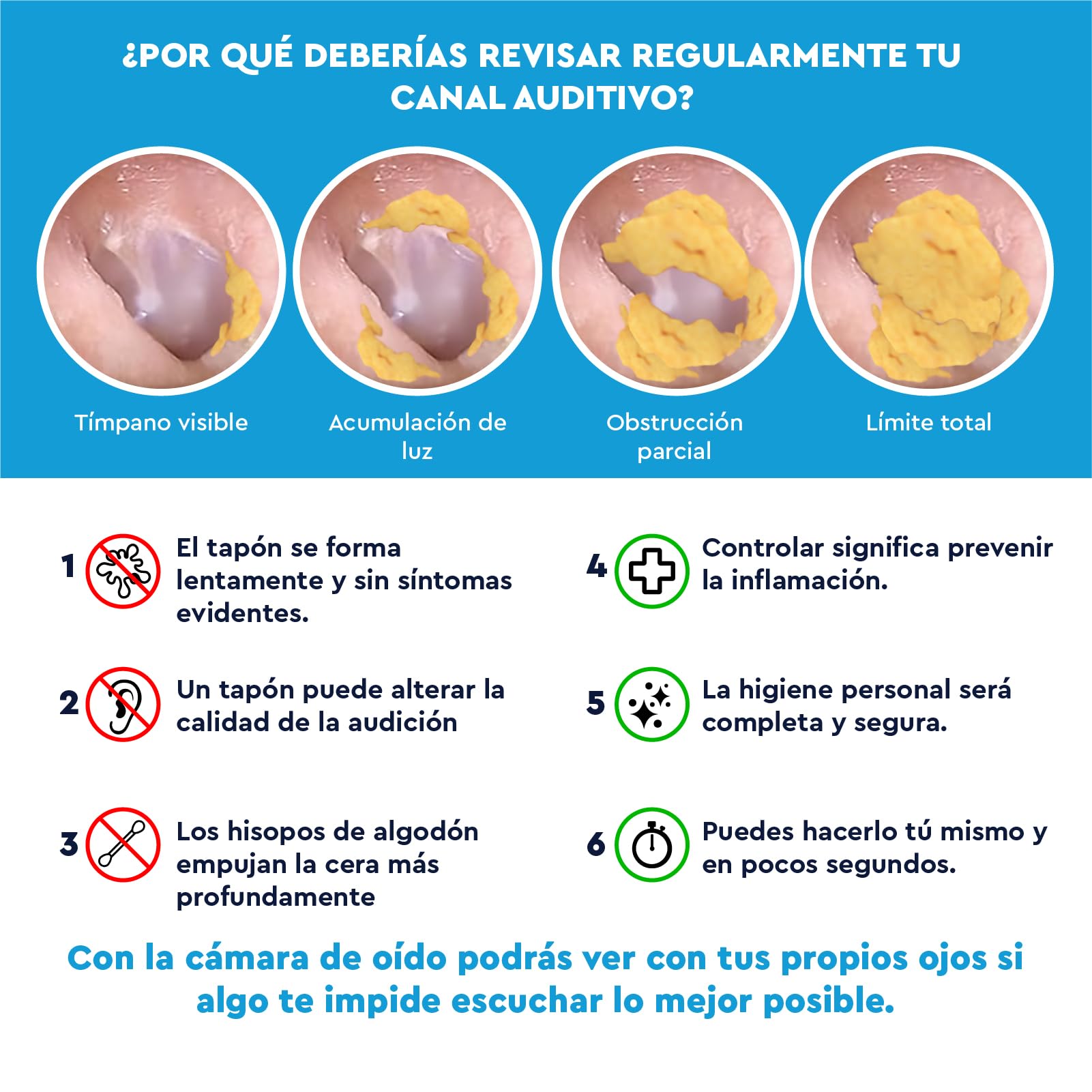 Otoscopio Limpiador de Oídos con Cámara HD 10MP WiFi Endoscopio Digital Flexible para Eliminación de Cerumen UdiGuard Pro-Clean - Pinzas y Puntas Reemplazables Kit Otorrinolaringología Adultos y Niños