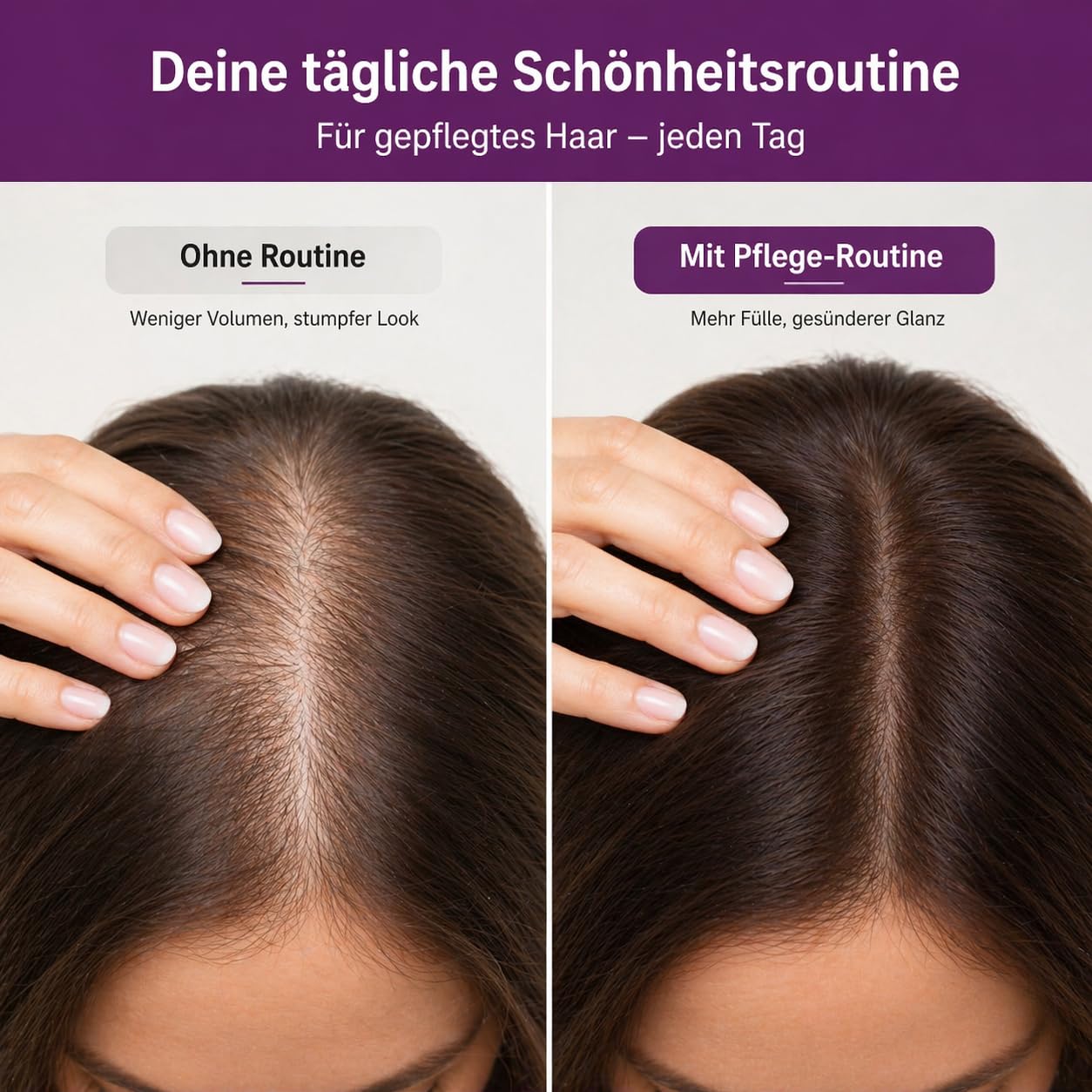 NUTRI-LEAF Haut-Haare-Nägel Kapseln hochdosiert mit Biotin, Silicium, Hirse, Brennnessel, Zink und B Vitaminen – Nahrungsergänzungsmittel (5)
