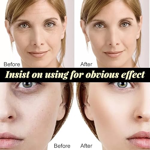 Miniatura 5 de Hilos de colágeno para estiramiento facial, antienvejecimiento, suero facial de colágeno, brillo de la piel, reduce líneas finas y arrugas, kits