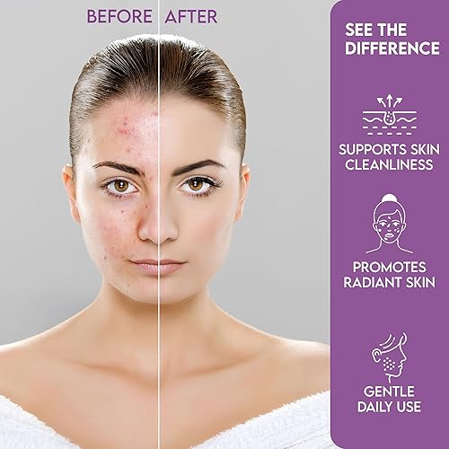 Miniatura 4 de Parches de acné de cara completa  10 parches hidrocoloides para espinillas para barbilla, nariz, frente y mejillas  Tratamiento de manchas de