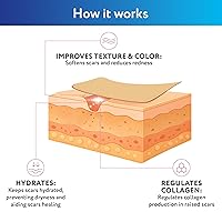 Vista 6 de ScarAway Hojas avanzadas de silicona para cicatrices de cesárea, tiras reutilizables (1.5 x 7 pulgadas) para cicatrices hipertróficas y queloides