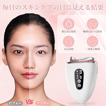 Amazon.co.jp: 【2025革新 温冷両用 】 美顔器 ems 温冷リフトかっさ