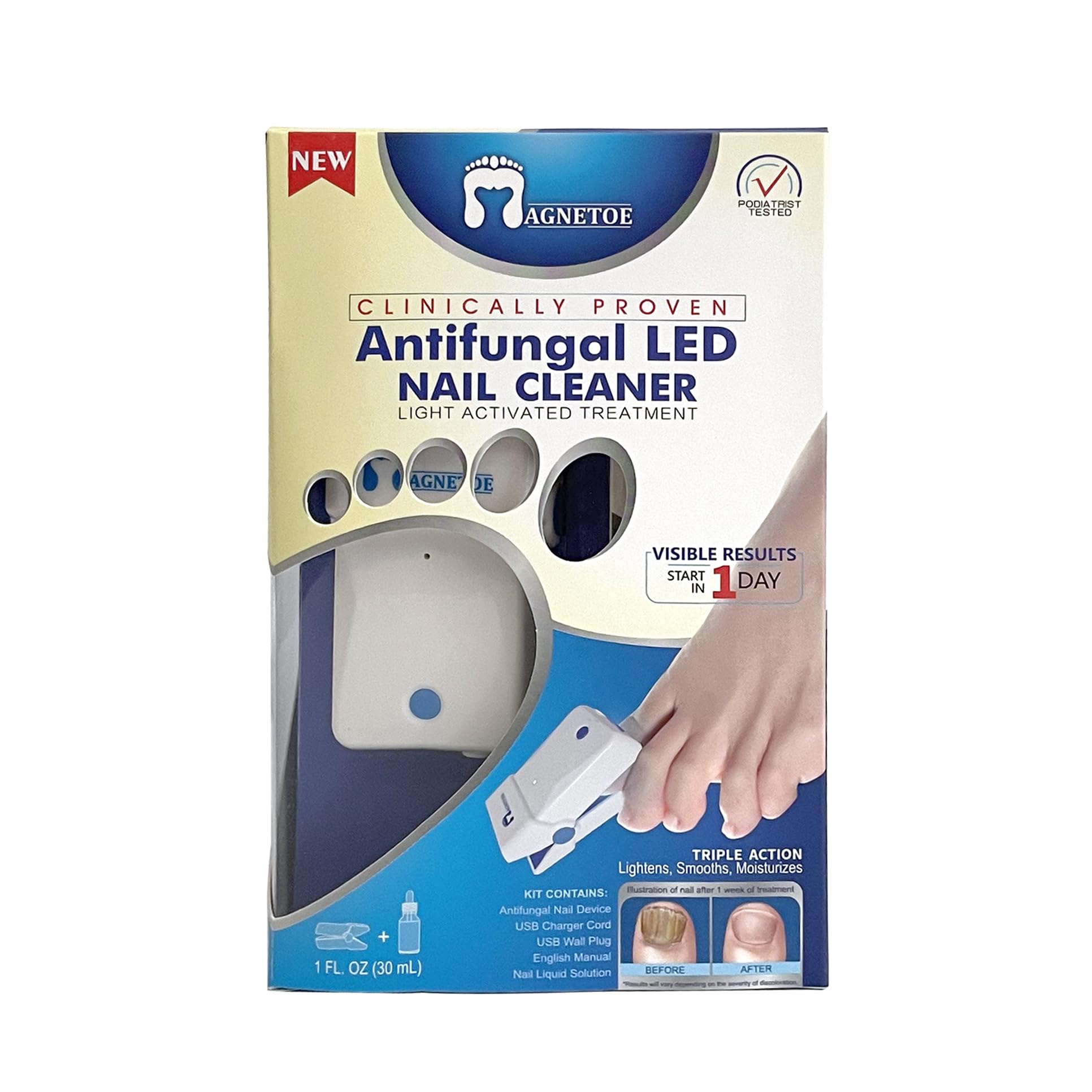 Emuaid Toenail Fungus Treatment by Infrared light Therapy Fungi Care
