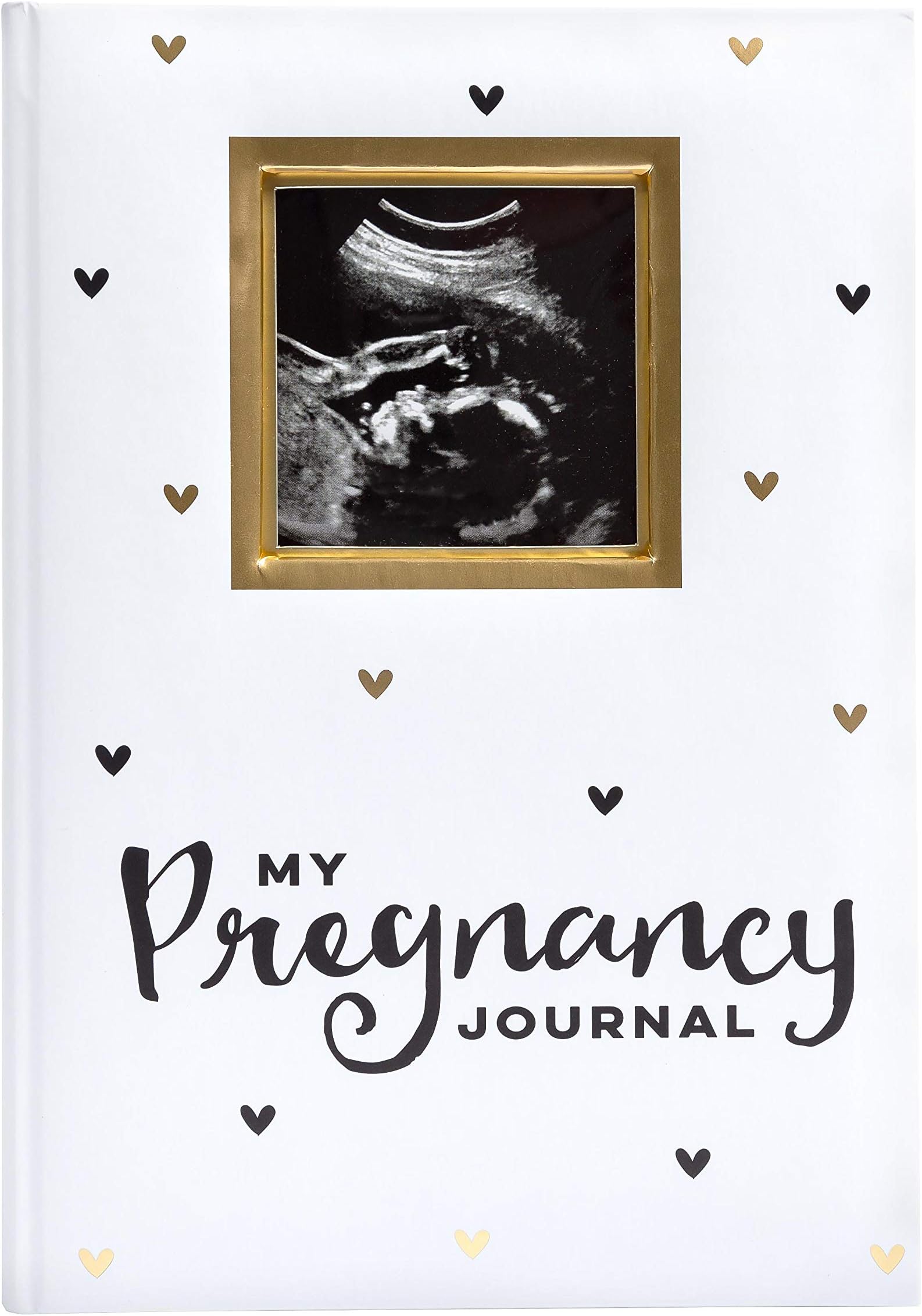 Pearhead My Pregnancy Journal, Baby Keepsake, Memory Book, White and Gold with Black Hearts