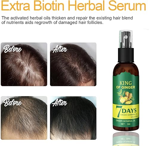 Miniatura 2 de Shouga Kingu Aceite de crecimiento del cabello, aceite de jengibre para el crecimiento del cabello, aceite germinal de jengibre 7 días, King of