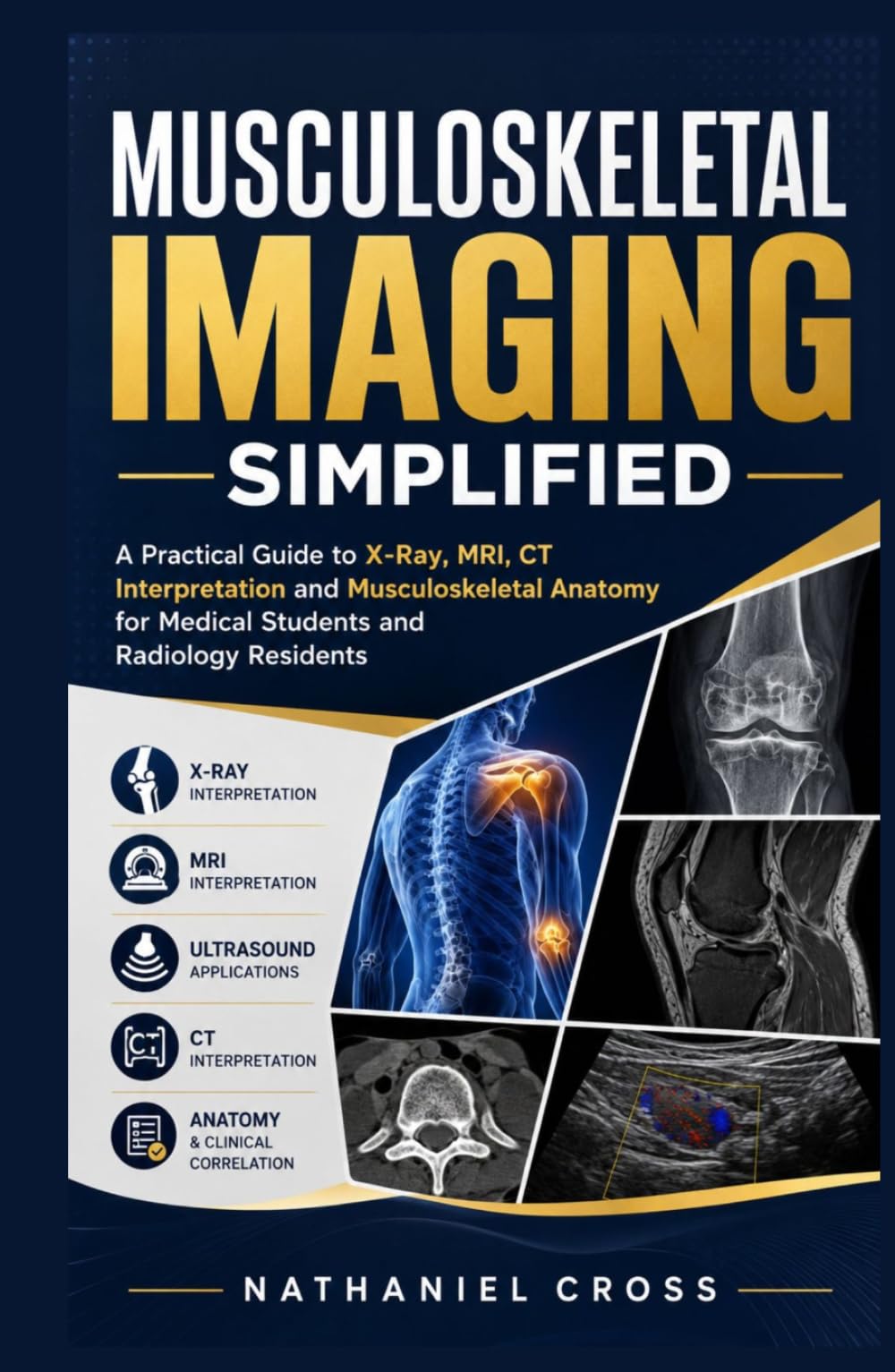 Musculoskeletal Imaging Simplified: A Practical Guide to X-Ray, MRI, CT Interpretation and Musculoskeletal Anatomy for Medical Students and Radiology Residents