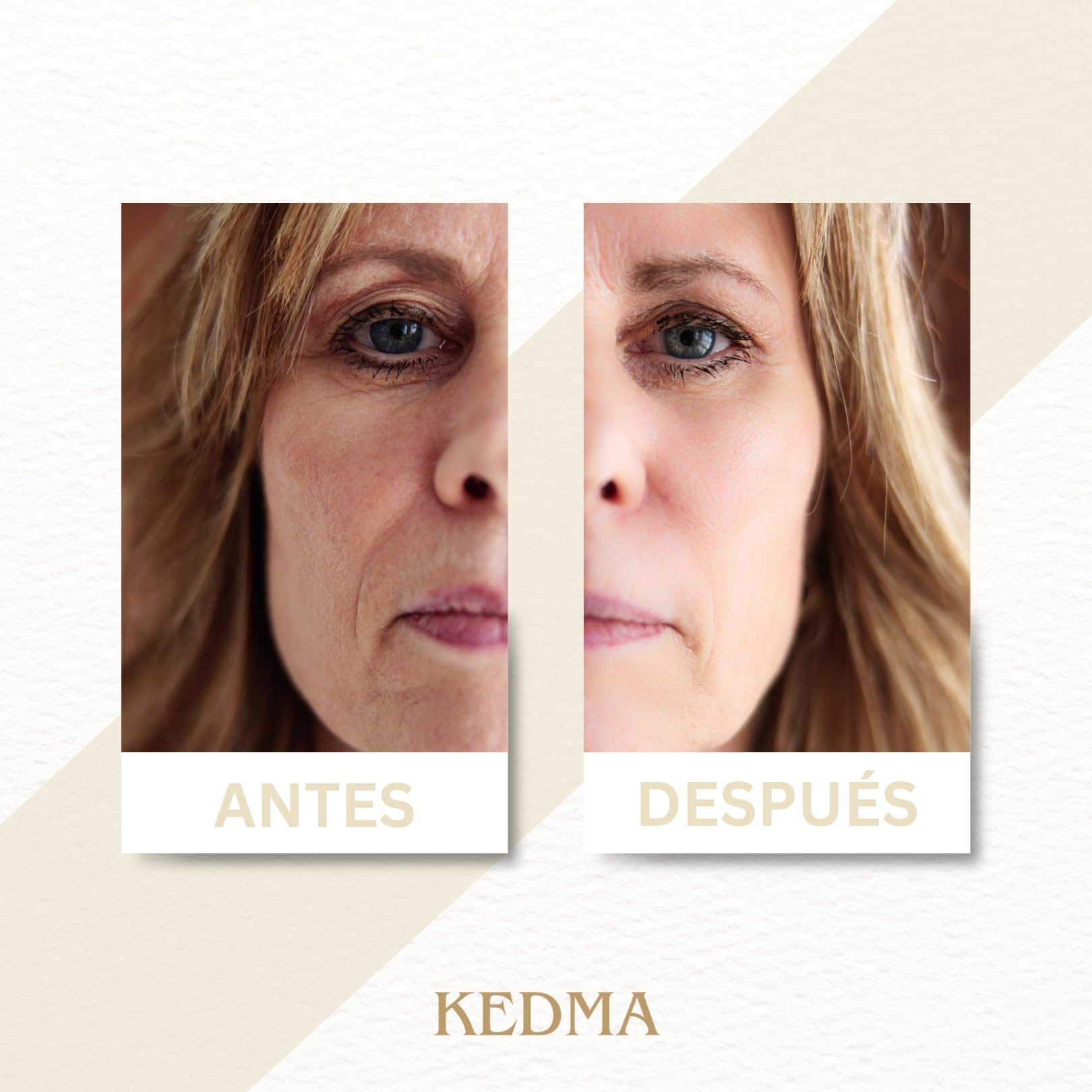 KEDMA - Cofre Facial de Colágeno - 4 Productos - 4 productos | El cofre de colágeno reúne mascarilla, crema, sérum y cuidado de cuello para hidratar y reafirmar.