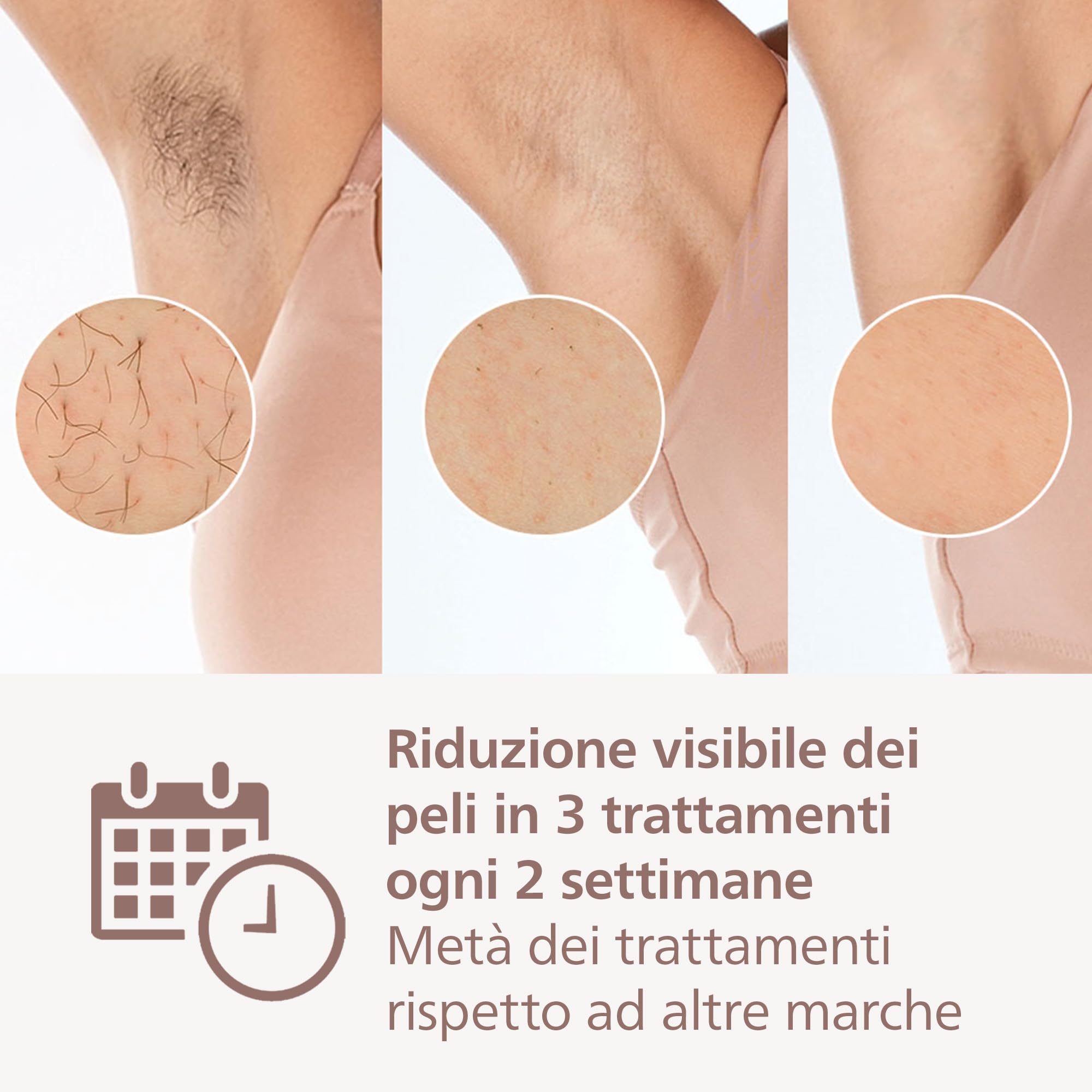 Philips Lumea Serie 9900, dispositivo di depilazione IPL, alternativa alla depilazione laser, tecnologia SenseIQ e SkinAI, 2 accessori per corpo e viso, BRI950/02