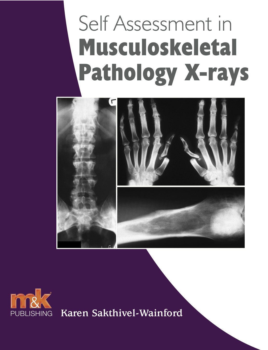 Self Assessment in Musculoskeletal Pathology Xrays (Selfassessment in