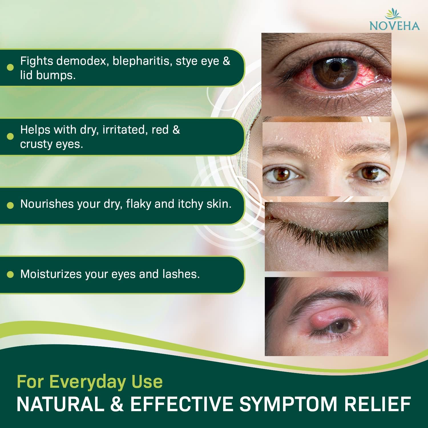 NOVEHA Demodex Eyelid Cleanser Foam | Extra Strength Tea Tree Oil Formula | Daily Face Wash For Eyelash, Demodex, MGD, Stye Eyes, Eye Irritations & Skin Dryness, 3.38 fl oz (3 Pack) - Image 2