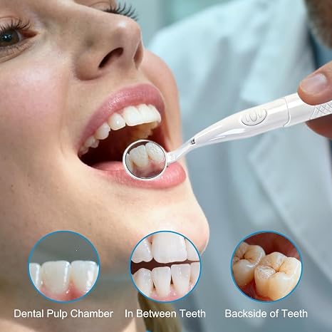 Dental Mirror with Light, Dental Mirror for Mouth with Extra Bright Light LED Teeth Inspection, Dentist Mirror for Teeth Cleaning Oral Hygiene Inspection in white