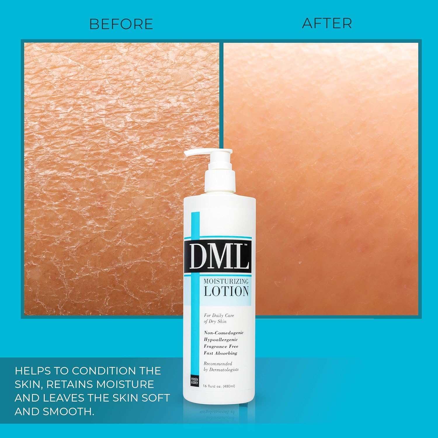 DML Moisturizing Lotion 16 oz (Pack of 6)