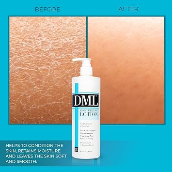 DML Moisturizing Lotion 16 oz (Pack of 6)