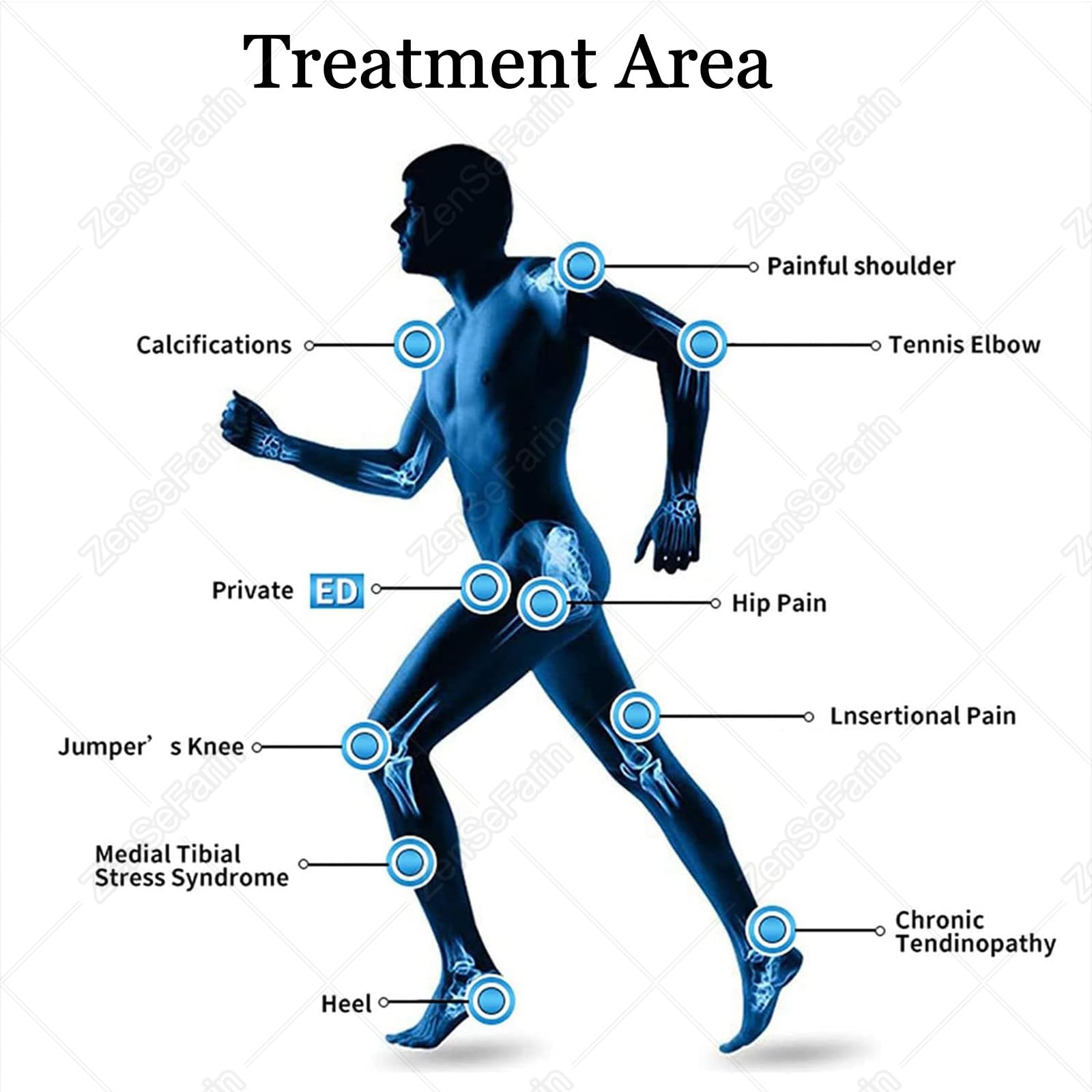 Apparecchio per terapia extracorporea a onde d'urto. Apparecchio per terapia a onde d'urto per il sollievo dal dolore articolare, muscolare, alle spalle e alla vita. Terapia extracorporea a onde