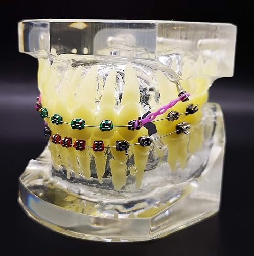 Miniatura 8 de Typodont dental con soportes metálicos Modelo de dientes de ortodoncia con ligadura