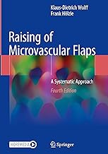 Raising of Microvascular Flaps: A Systematic Approach