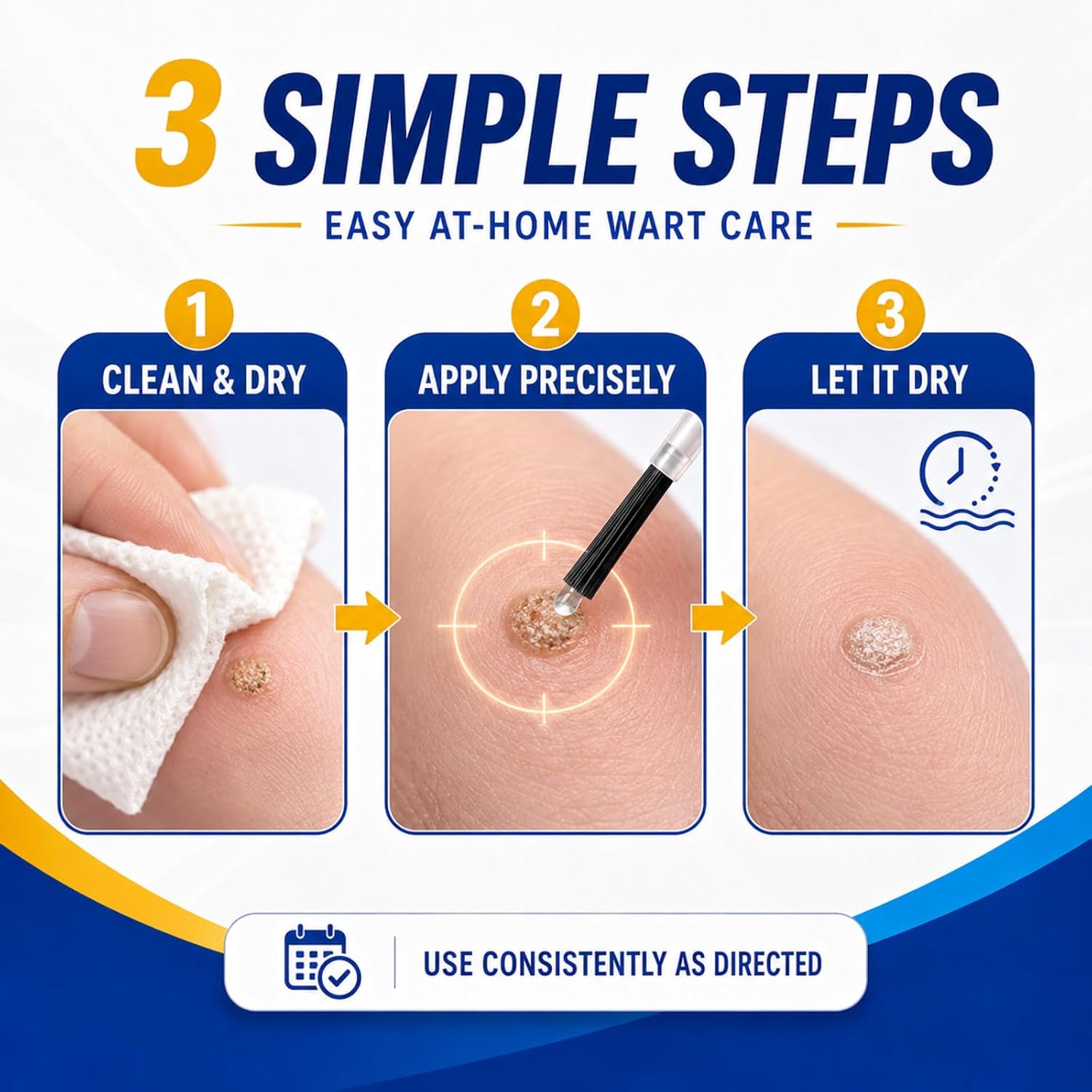 40% Salicylic Acid Wart Remover, Common, Plantar & Flat Warts, Neck & Body