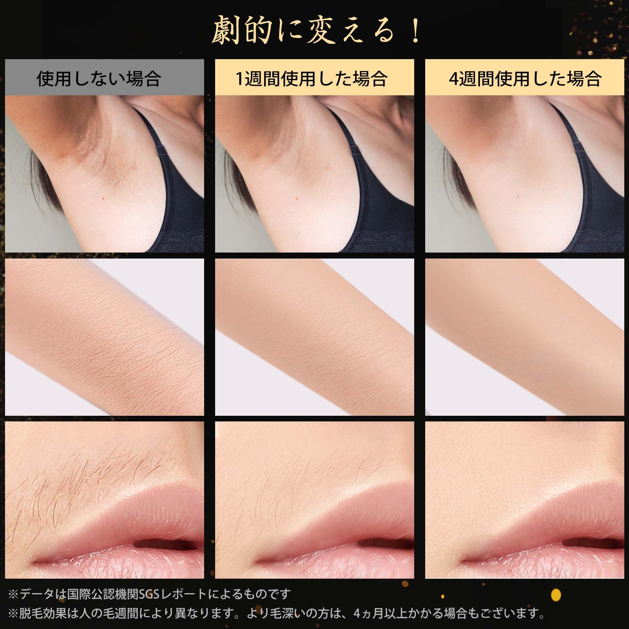 HZCYS 脱毛器 Air Pro メンズ レディース VIO対応 髭 腕など Amazon | ◇2024夏に向けて最新モデル【業界最高峰パワー x 刺激レス