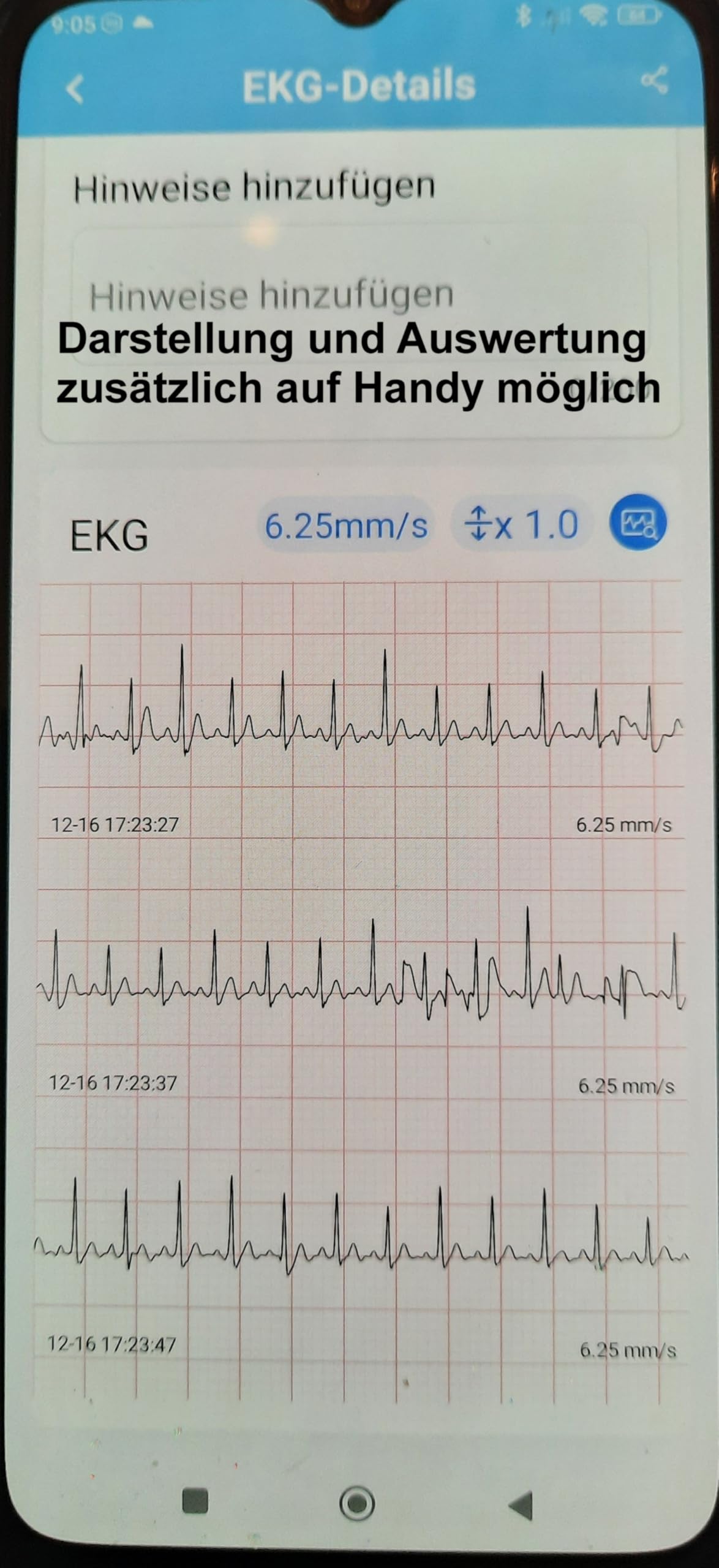 Tragbares EKG Gerät Bluetooth 30 Sekunden Handmessung-Langzeit Messung 22 Stunden mit EKG Kabel für zu Hause Vorhofflimmern-inkl. PC Auswertungssoftware ausdrucken - Deutsche Anleitung