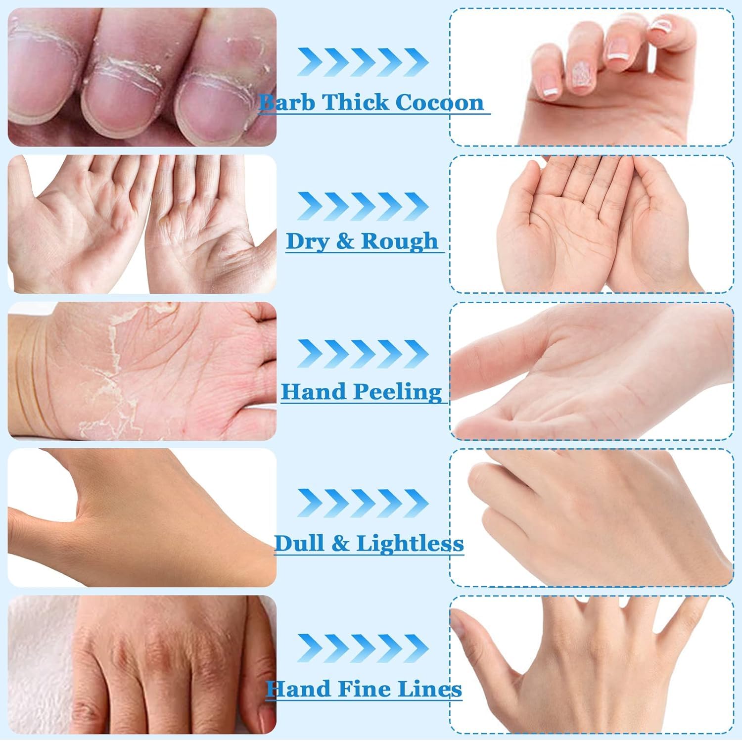 Milk Niacinamide Maschera idratante per le mani, 6 maschere per le mani con latte e niacinamidi, maschera per la cura intensiva delle mani contro le mani secche, per pelli delicate e luminose