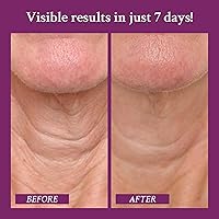 Vista 3 de PRAI Beauty Ageless Throat & Décolletage Neck Creme 6.8 Oz Crepe Erase, crema antiarrugas para mujeres, crema para el cuello, cremas para el cuello