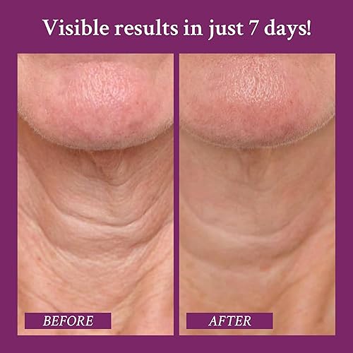 Miniatura 3 de PRAI Crema para el cuello para tensar y reafirmar la belleza | Crema reafirmante para el cuello que aumenta la elasticidad | Crema para tensar el