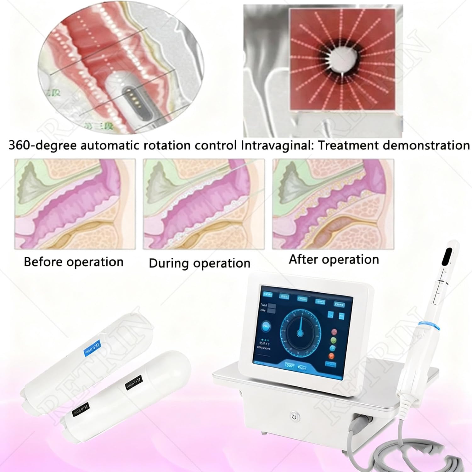 Qiang Dispositivo Professionale Riparazione Pavimento Pelvico Postpartum: Stimolatore Muscolare per Il Rafforzamento, Il Controllo della Vescica e la Salute Pelvica Femminile