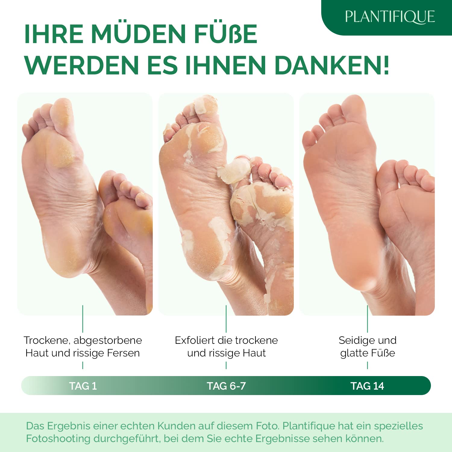 Hornhaut entfernen fußmaske Clearance