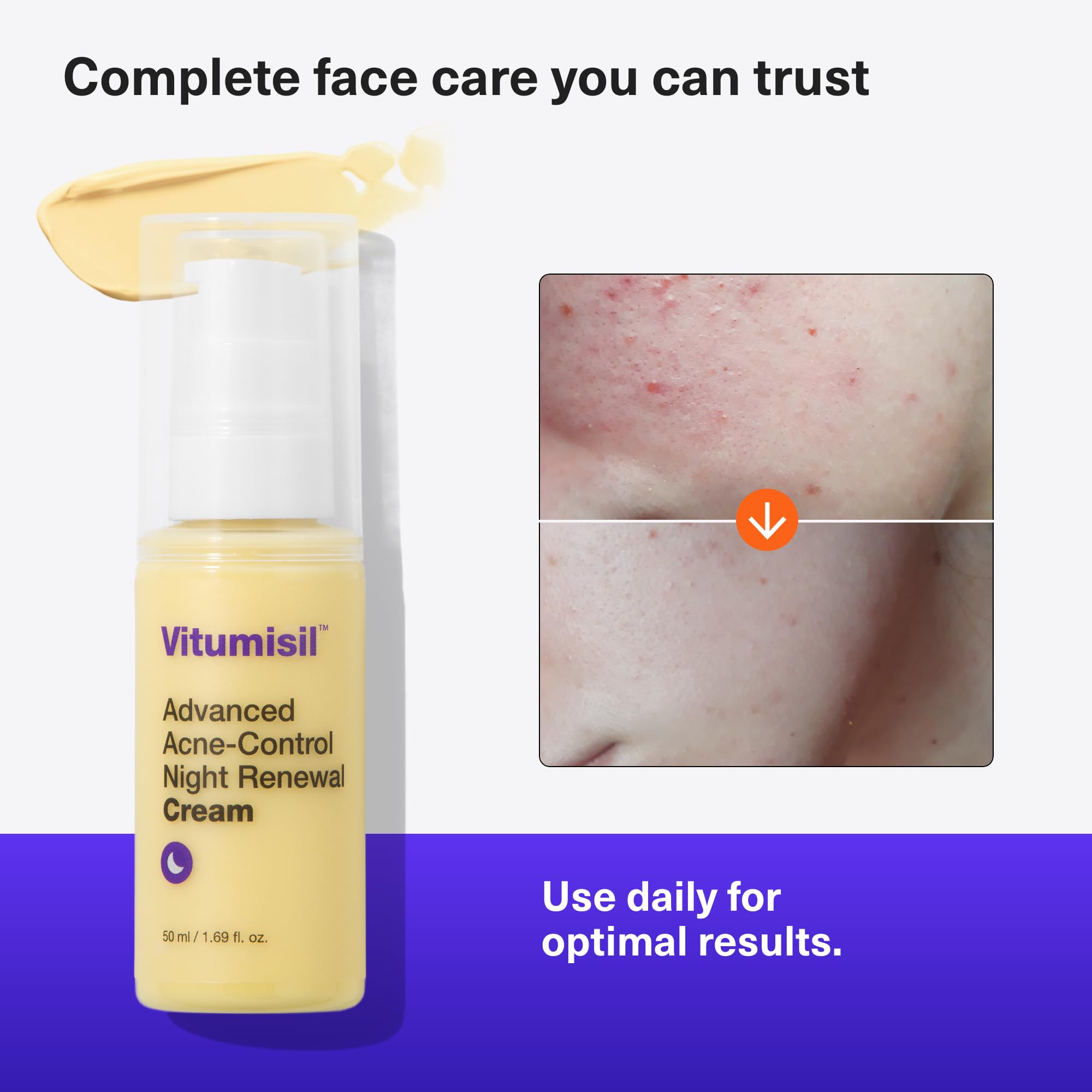 Dermz Vitumisil Active Night Cream (50 ml) is a regenerating overnight moisturiser carefully formulated for sensitive acne-prone - Image 4