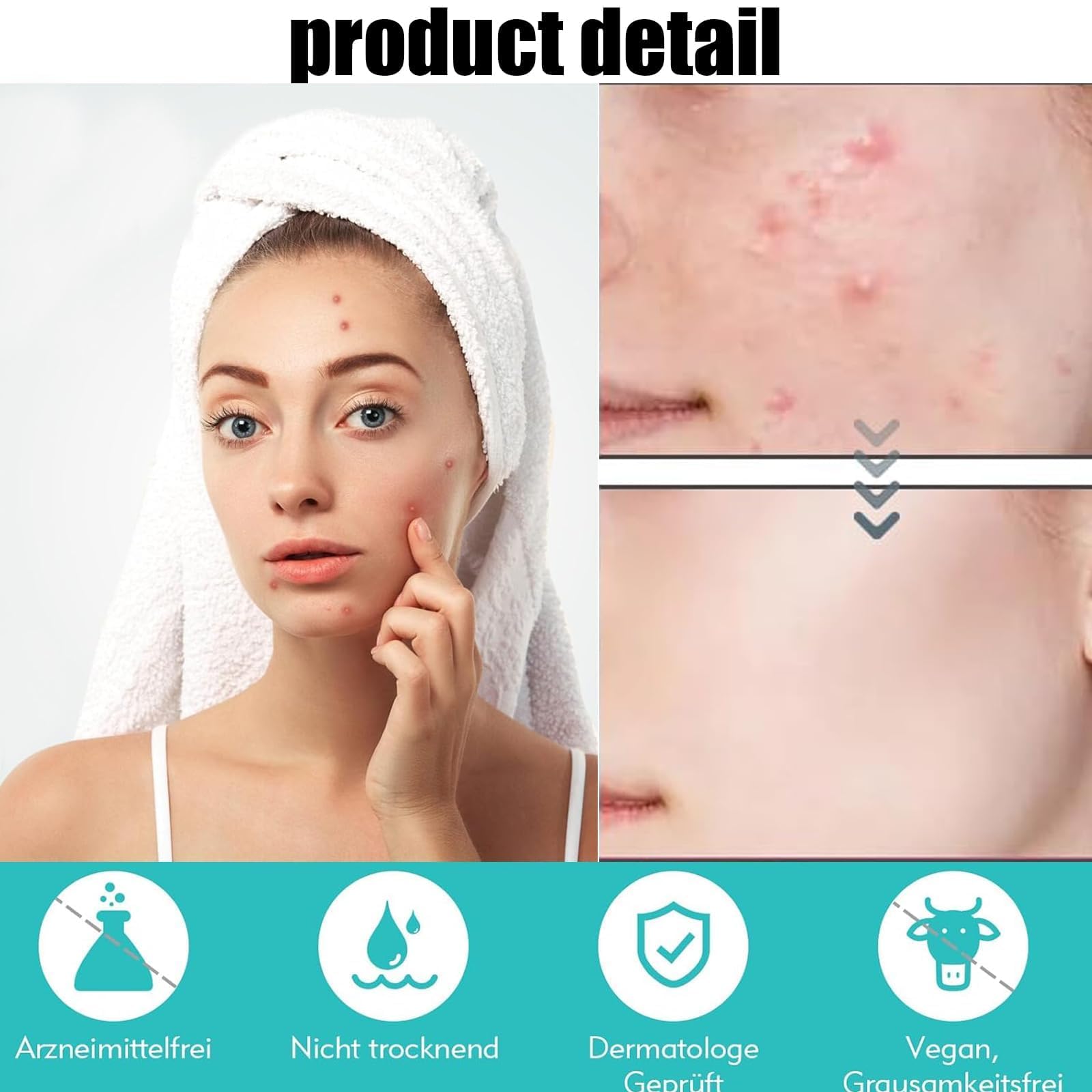200 PCS Pimple Patches Stars, Hydrocolloid Acne Patches, Spot Patches, Hydrocolloid Patches for Pimples Blemishes - Image 3