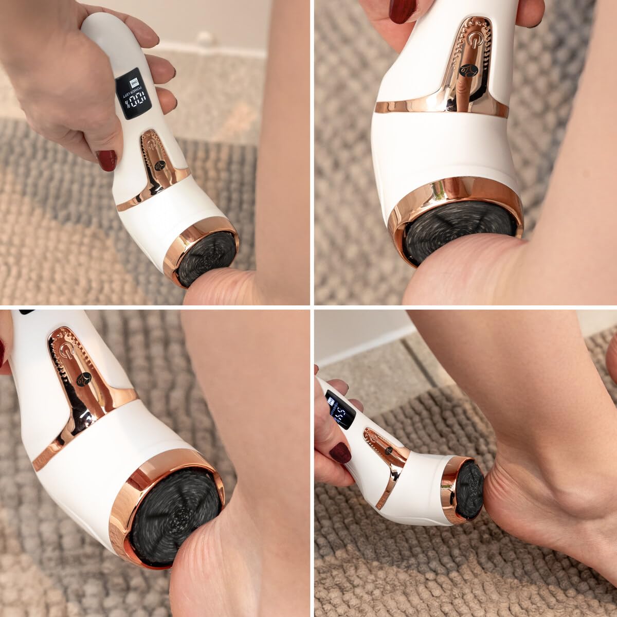 Rio Go Smooth Electric Foot File Hard Skin Remover with Vacuum Action - Image 2