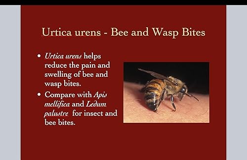 Miniatura 5 de Urtica Urens Crema 1 Pack