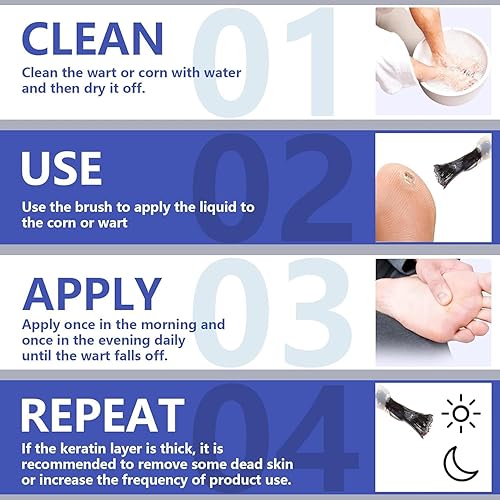 Miniatura 6 de Thcbme Máscara líquida de gel para verrugas y maíz de máxima fuerza, fórmula exclusiva para eliminar rápidamente las verrugas plantares, verrugas