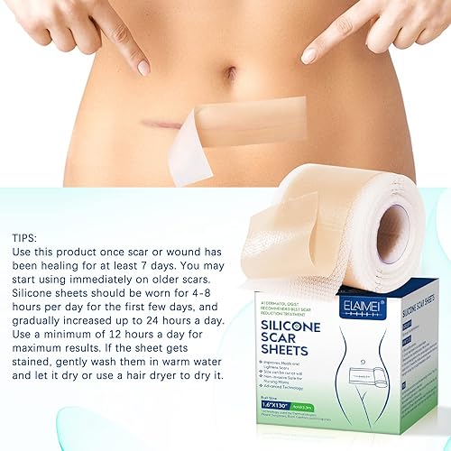 Miniatura 5 de Hojas de silicona para cicatrices (1.6 x 130 pulgadas, 10.8 ft), cinta de silicona profesional para cicatrices, tiras de cicatrices de silicona,