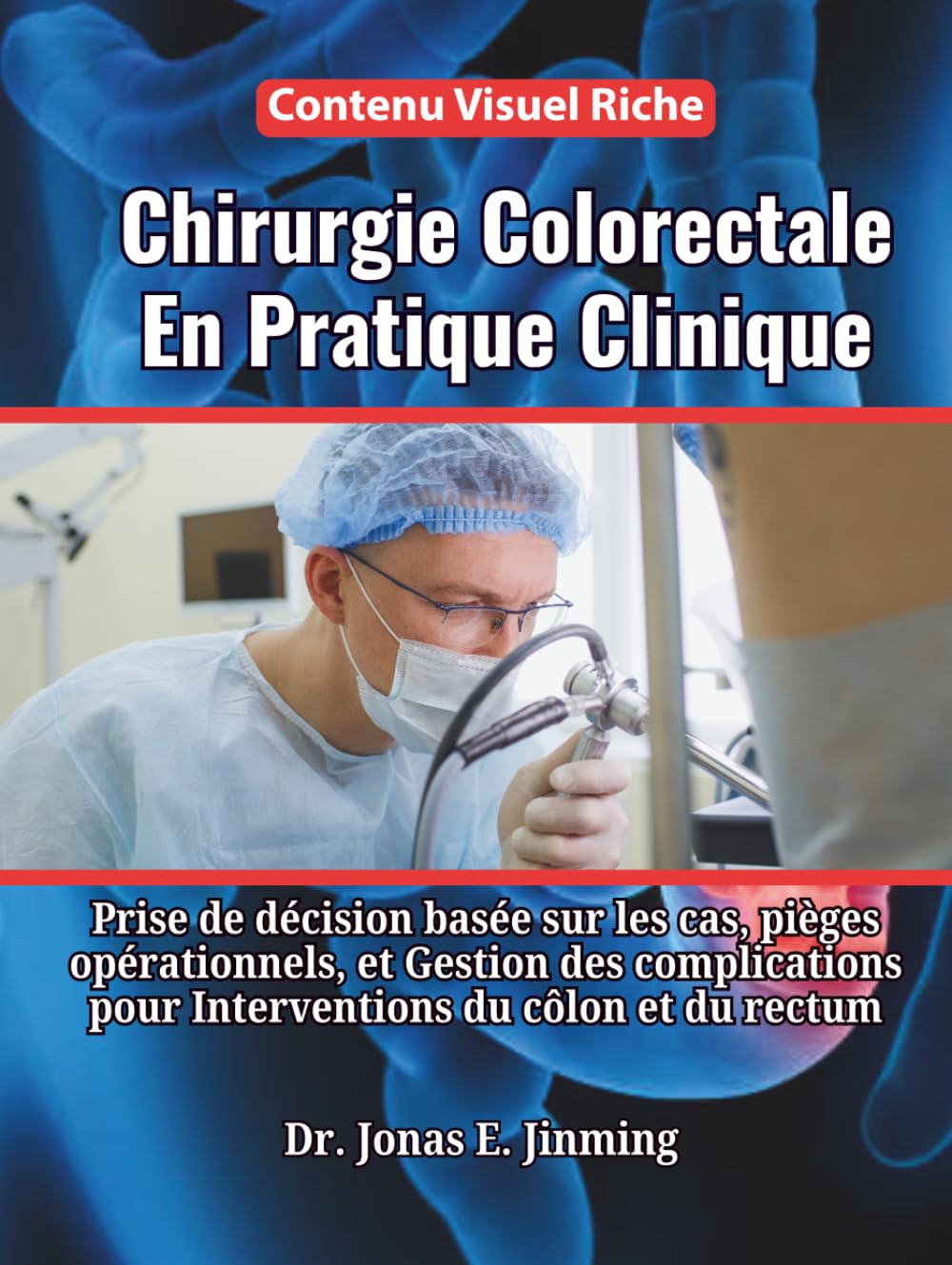 Chirurgie Colorectale En Pratique Clinique: Prise de décision basée sur les cas, pièges opérationnels, et Gestion des complications pour Interventions du côlon et du rectum