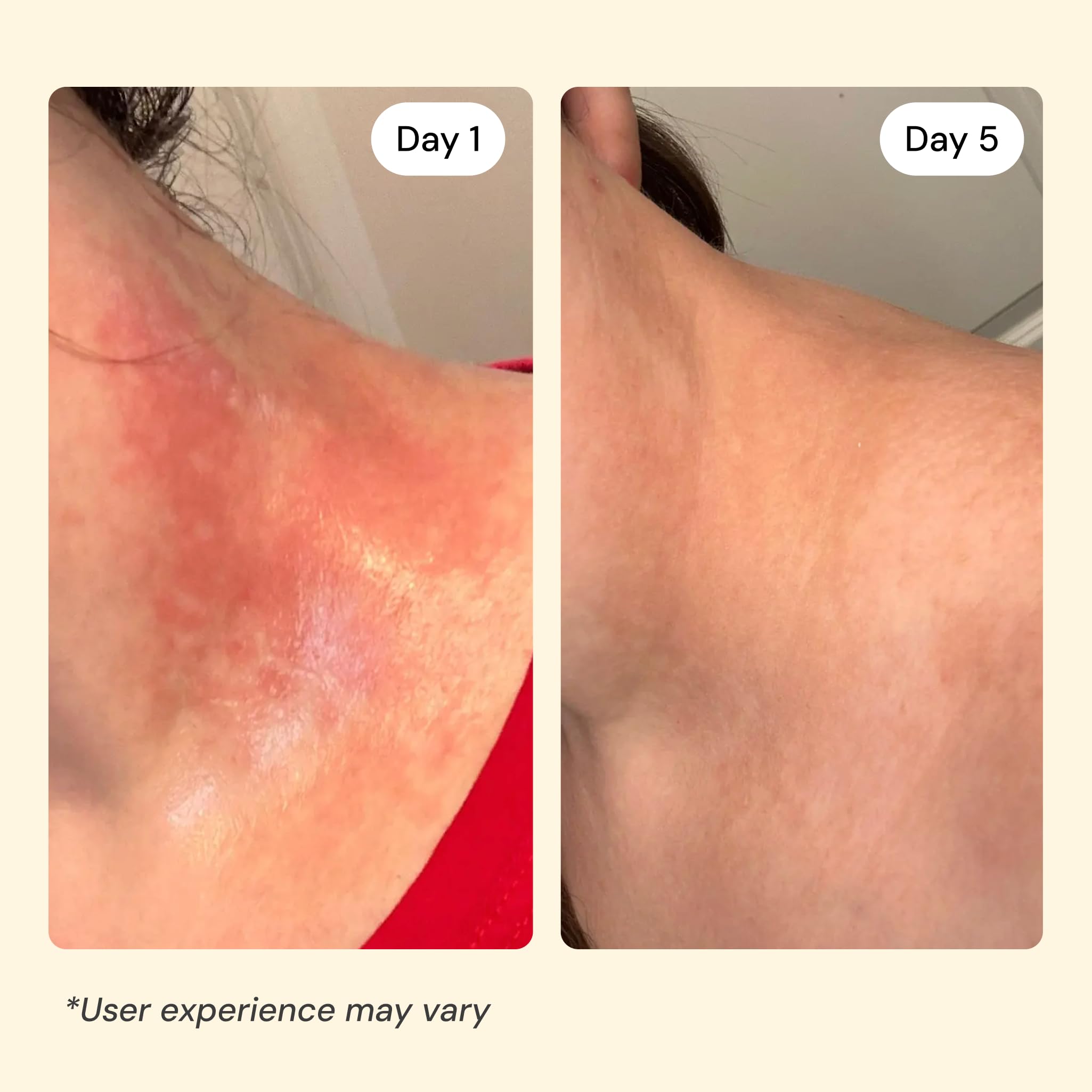 MyMagicHealer Universal Flare Care Sensitive Skin Solution with Propolis & Egg Yolk
