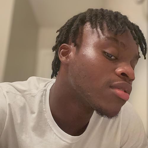 Miniatura 9 de Parches hidrocoloides a juego para espinillas - Parches invisibles para acné para cara, 3 tamaños, 72 unidades (1 paquete), parches que coinciden