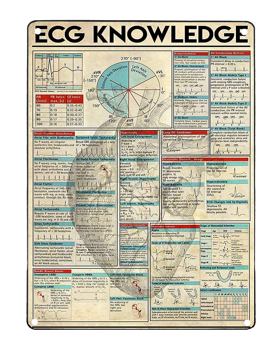 peiyeety Ecg Knowledge Posters Cardiologists Popular Science Metal Signsroom Decor Home Club Wall Decor Retro Plaque 8"x12"