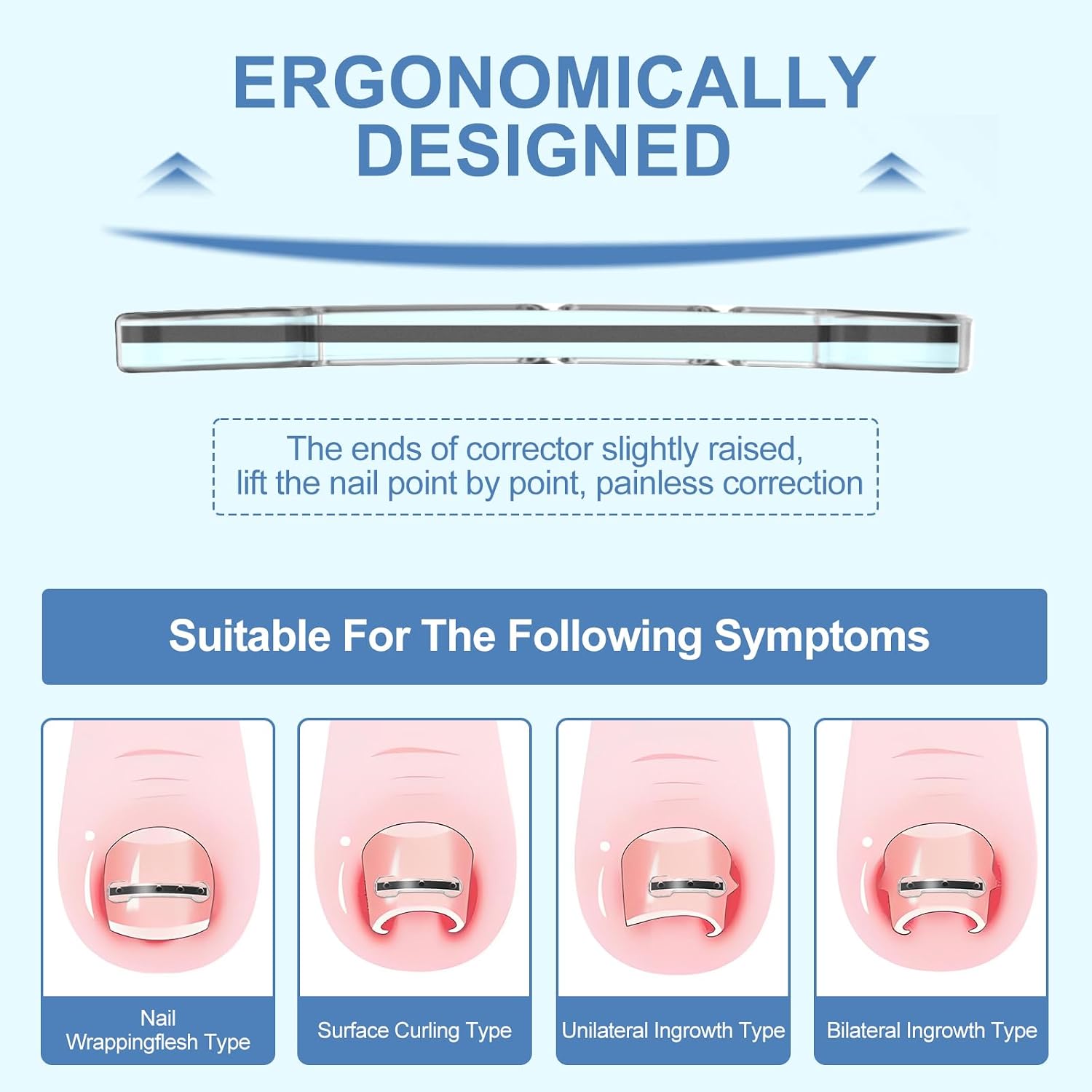4 Multi-Sizes Ingrown Toenail Treatment Corrector for Toenail Quick Relief
