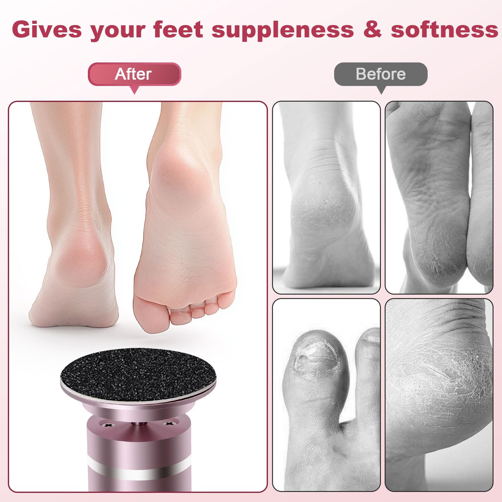 Hornhautentferner Elektrisch, 2 in 1 Elektrischer Hornhautentferner für Füße & Nagelpflege mit LCD Display und 9 Stufens, Wiederaufladbare Foot Glow Hornhaut Entferner für rissige Fersen,Hornha