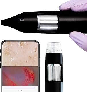 Digital Otoscope and Dermascope in Single Device (Oto-Dermascope) for Clinical Examination and Saving Pictures and Videos