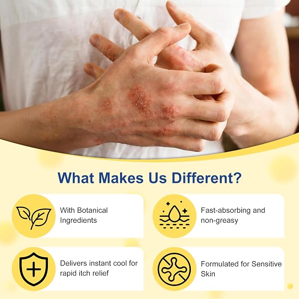 Psoriasis Cream, Natural Seborrheic Dermatitis Relief for Itchy Flaky Skin, Soothing Ointment for Redness & Scaling 20g - 2