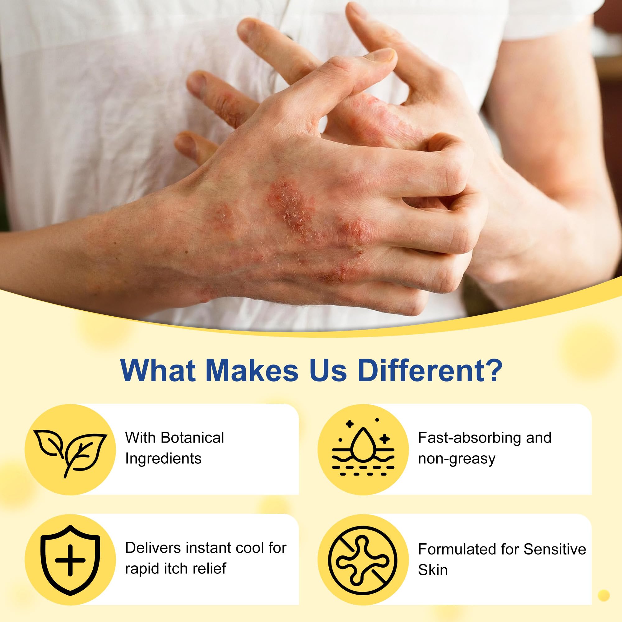 Psoriasis Cream, Natural Seborrheic Dermatitis Relief for Itchy Flaky Skin, Soothing Ointment for Redness & Scaling 20g - 2
